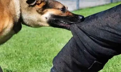 Addl Collector at Siddipet collectorate complex bitten by stray dog