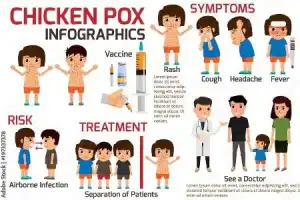 Increase in Chickenpox Cases Among School Children Observed in Hyderabad City