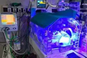 Niloufer’s eSNCU Concept in Hyderabad Shows Promise in Reducing Infant Mortality Rates in the State