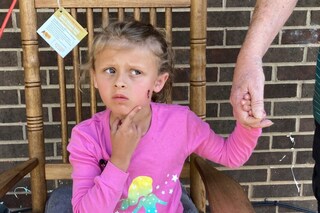 US Man Shoots Four People, Including a 6-Year-Old, After Basketball Rolls into His Yard: A First-Hand Account of a Bullet Wound to the Cheek.