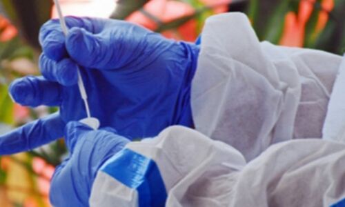 Ayush Doctors in Punjab requested by Government to work as Tele Callers.