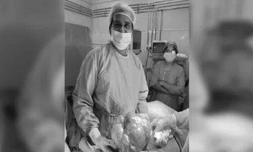 Successful removal of 7kg Ovarian Cyst by surgeons at Osmania General Hospital in Hyderabad