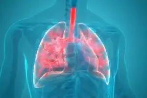 Surge in Pneumonia Cases Reported in Hyderabad