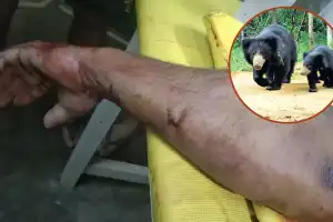 Company employee in Nagarkurnool attacked by bear