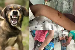 Mad dogs attack seven children