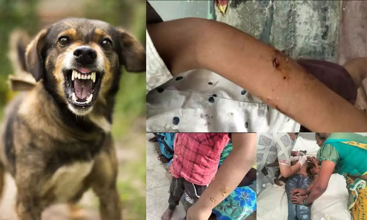 Mad dogs attack seven children