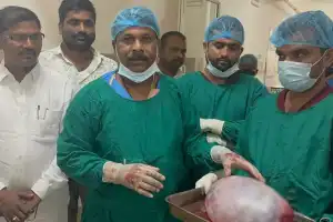 Achampet Hospital’s MLA Dr Vamshikrishna Removes 10 kg Tumor