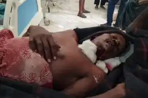 An intoxicated wife attacked her husband with an axe