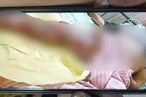Enigmatic Disease Strikes Bonkur Village