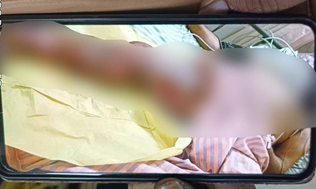 Enigmatic Disease Strikes Bonkur Village