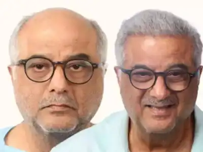 Boney Kapoor shares his experience with hair restoration