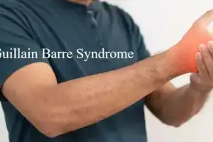 Health experts clarify that GBS is not contagious