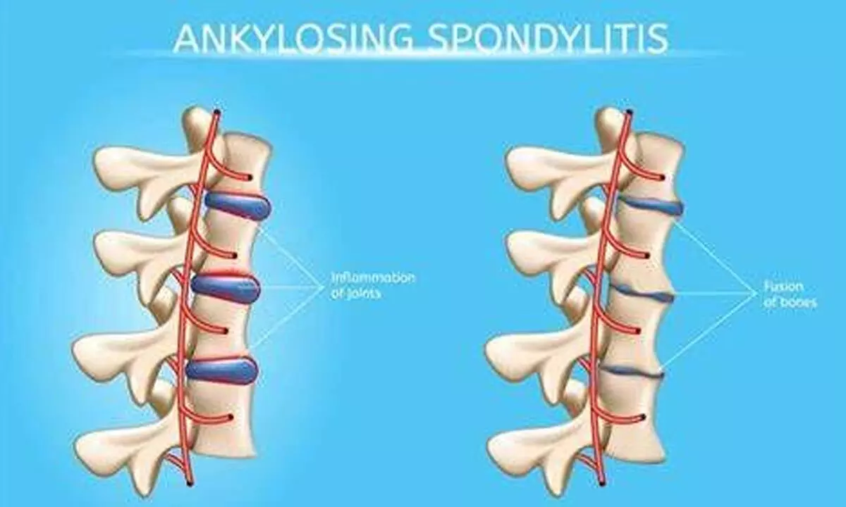 CCMB study finds hereditary diseases linked to endogamy