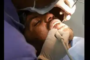 Hyderabad dentists warn about widespread illegal practice