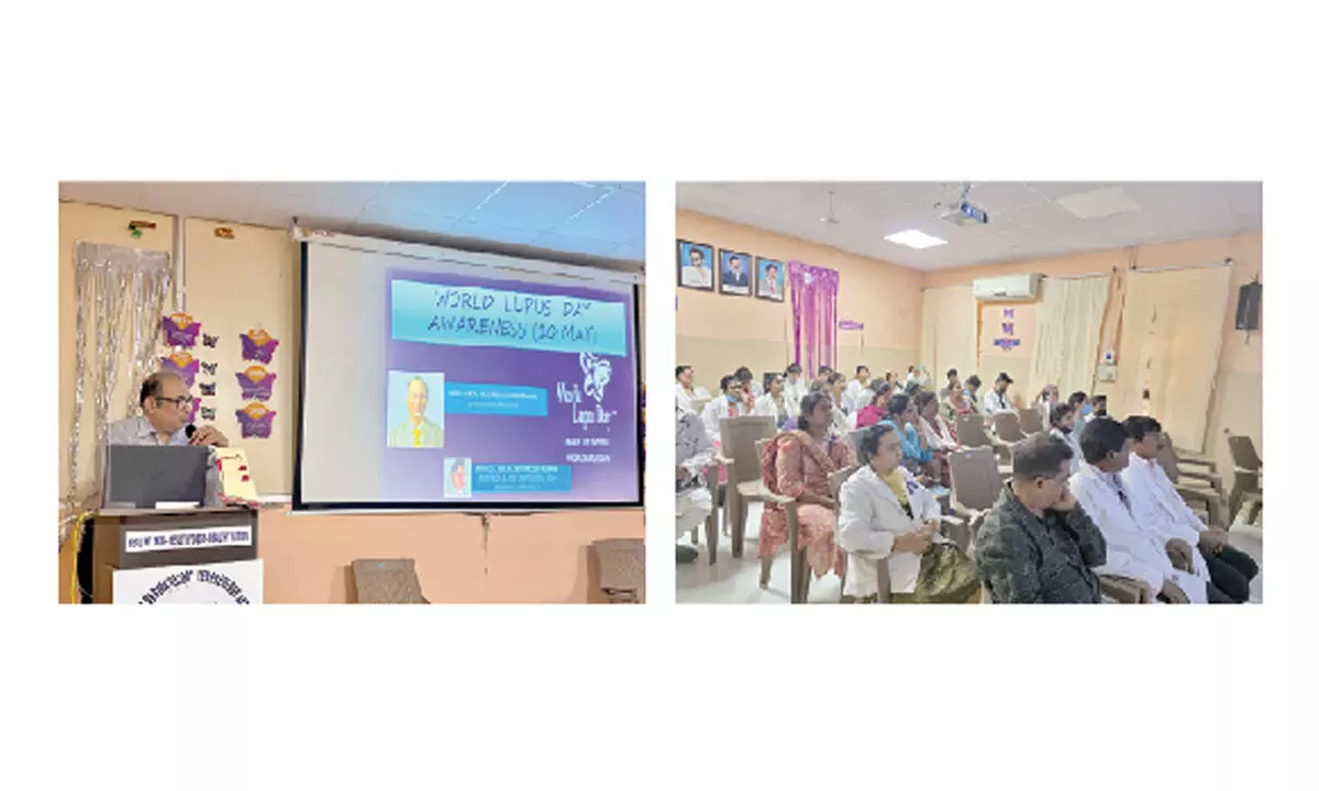 Event Held to Raise Awareness on World Lupus Day