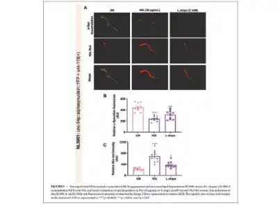 Neurogrit Gold offers new hope for Parkinson’s treatment