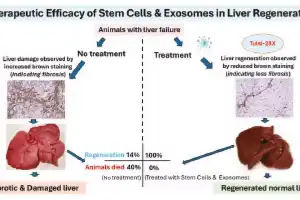 Hyderabad startup makes world-first breakthrough in liver treatment