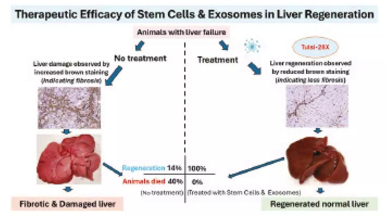 Hyderabad startup makes world-first breakthrough in liver treatment