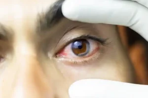 19 Firecracker Injury Cases Reported at Sarojini Devi Eye Hospital After Diwali, 11 Children Among Victims